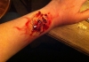 FX makeup has been to applied to an arm to make it look as if the person is injured, with their skin torn and blood in the wound FX makeup has been to applied to an arm to make it look as if the person is injured, with their skin torn and blood in the wound